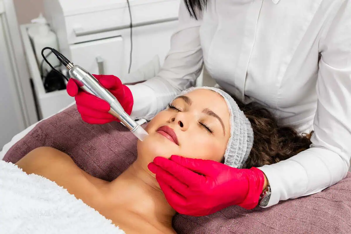 Microneedling in Cincinnati, OH The Clearexperience